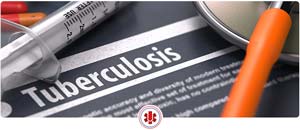 TB Testing Near Me in El Paso, TX and Horizon City, TX TB Testing Near Me in El Paso, TX and Horizon City, TX