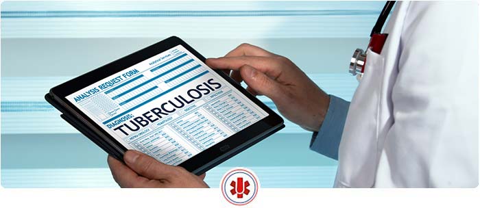 04 Questions to Ask About TB Testing Near Me in El Paso, TX and Horizon City, TX 04 Questions to Ask About TB Testing Near Me in El Paso, TX and Horizon City, TX