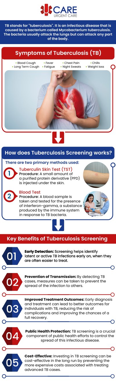 A tuberculosis screening test checks to see if you have the bacteria (germs) that cause tuberculosis (TB) in your body. UCare Urgent Care and Walk-In Clinic offer TB Testing near you. For more information, contact us today! We are a walk-in clinic located at Horizon City TX, on North Zaragoza Rd. in El Paso TX, and on Lee Trevino Dr. in El Paso TX.