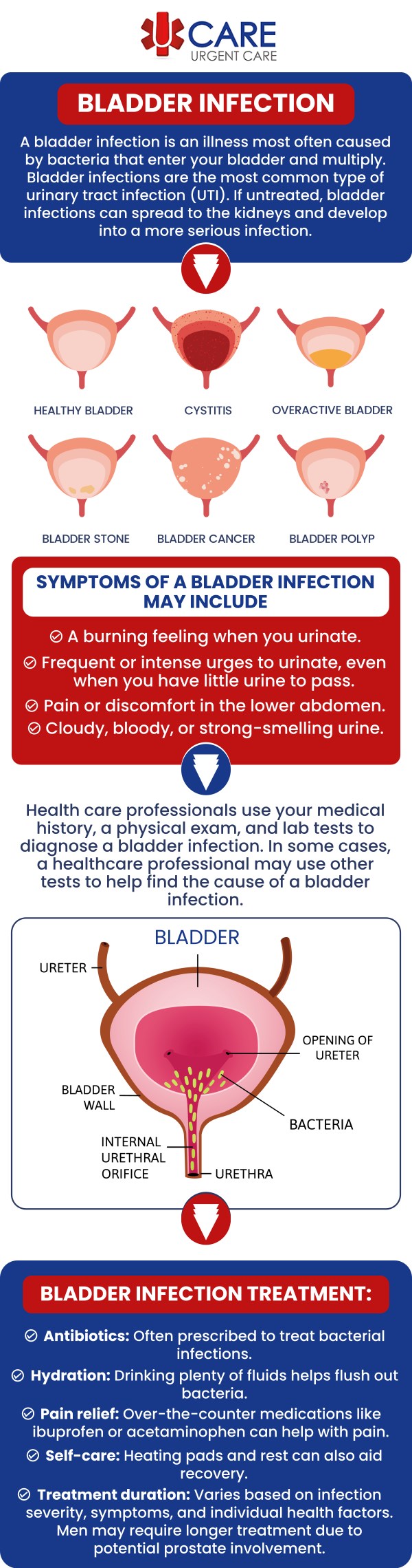 A bladder infection occurs when bacteria enter the urinary tract and affect the bladder, often causing uncomfortable urinary symptoms that may worsen without timely care. Common signs can include burning or pain during urination, frequent urges to urinate, lower abdominal pressure, cloudy urine, or a persistent feeling that the bladder has not fully emptied. UCare Urgent Care and Walk-In Clinic in Horizon City, TX provides convenient evaluation for non-emergency bladder infection symptoms. Our medical team reviews each patient’s symptoms, medical history, and overall condition to determine appropriate treatment and whether additional follow-up may be needed. For more information, contact us or book an schedule an appointment. We are conveniently located at 13472 Eastlake Blvd, Horizon City, TX 79928. A bladder infection occurs when bacteria enter the urinary tract and affect the bladder, often causing uncomfortable urinary symptoms that may worsen without timely care. Common signs can include burning or pain during urination, frequent urges to urinate, lower abdominal pressure, cloudy urine, or a persistent feeling that the bladder has not fully emptied. UCare Urgent Care and Walk-In Clinic in Horizon City, TX provides convenient evaluation for non-emergency bladder infection symptoms. Our medical team reviews each patient’s symptoms, medical history, and overall condition to determine appropriate treatment and whether additional follow-up may be needed. For more information, contact us or book an schedule an appointment. We are conveniently located at 13472 Eastlake Blvd, Horizon City, TX 79928.