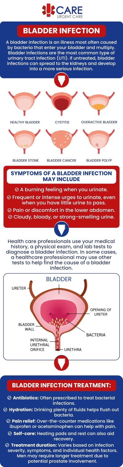 A bladder infection occurs when bacteria enter the urinary tract and affect the bladder, often causing uncomfortable urinary symptoms that may worsen without timely care. Common signs can include burning or pain during urination, frequent urges to urinate, lower abdominal pressure, cloudy urine, or a persistent feeling that the bladder has not fully emptied. UCare Urgent Care and Walk-In Clinic in Horizon City, TX provides convenient evaluation for non-emergency bladder infection symptoms. Our medical team reviews each patient’s symptoms, medical history, and overall condition to determine appropriate treatment and whether additional follow-up may be needed. For more information, contact us or book an schedule an appointment. We are conveniently located at 13472 Eastlake Blvd, Horizon City, TX 79928. A bladder infection occurs when bacteria enter the urinary tract and affect the bladder, often causing uncomfortable urinary symptoms that may worsen without timely care. Common signs can include burning or pain during urination, frequent urges to urinate, lower abdominal pressure, cloudy urine, or a persistent feeling that the bladder has not fully emptied. UCare Urgent Care and Walk-In Clinic in Horizon City, TX provides convenient evaluation for non-emergency bladder infection symptoms. Our medical team reviews each patient’s symptoms, medical history, and overall condition to determine appropriate treatment and whether additional follow-up may be needed. For more information, contact us or book an schedule an appointment. We are conveniently located at 13472 Eastlake Blvd, Horizon City, TX 79928.