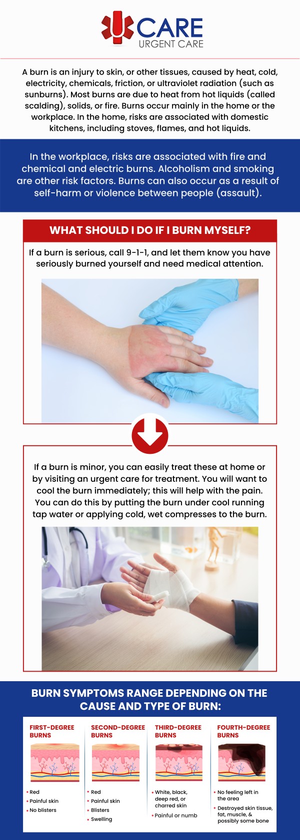 Minor burns can cause pain, redness, swelling, and skin irritation that may require timely medical attention to support proper healing. At UCare Urgent Care and Walk-In Clinic, our skilled team provides minor burns treatment in Horizon City, TX, for patients experiencing common burn concerns from everyday situations. We evaluate the affected area, assess the severity of the burn, and recommend appropriate care based on each patient’s needs. Whether a minor burn occurs at home, work, or during daily activities, our clinic offers convenient urgent care services to help patients receive prompt evaluation and treatment. For more information, contact us or book an appointment online. We are conveniently located at 13472 Eastlake Blvd, Horizon City, TX 79928. Minor burns can cause pain, redness, swelling, and skin irritation that may require timely medical attention to support proper healing. At UCare Urgent Care and Walk-In Clinic, our skilled team provides minor burns treatment in Horizon City, TX, for patients experiencing common burn concerns from everyday situations. We evaluate the affected area, assess the severity of the burn, and recommend appropriate care based on each patient’s needs. Whether a minor burn occurs at home, work, or during daily activities, our clinic offers convenient urgent care services to help patients receive prompt evaluation and treatment. For more information, contact us or book an appointment online. We are conveniently located at 13472 Eastlake Blvd, Horizon City, TX 79928.