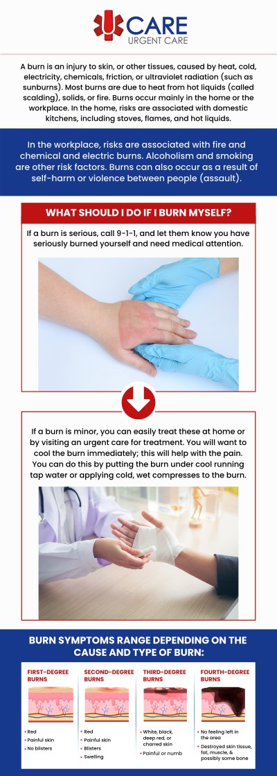 Minor burns can cause pain, redness, swelling, and skin irritation that may require timely medical attention to support proper healing. At UCare Urgent Care and Walk-In Clinic, our skilled team provides minor burns treatment in Horizon City, TX, for patients experiencing common burn concerns from everyday situations. We evaluate the affected area, assess the severity of the burn, and recommend appropriate care based on each patient’s needs. Whether a minor burn occurs at home, work, or during daily activities, our clinic offers convenient urgent care services to help patients receive prompt evaluation and treatment. For more information, contact us or book an appointment online. We are conveniently located at 13472 Eastlake Blvd, Horizon City, TX 79928. Minor burns can cause pain, redness, swelling, and skin irritation that may require timely medical attention to support proper healing. At UCare Urgent Care and Walk-In Clinic, our skilled team provides minor burns treatment in Horizon City, TX, for patients experiencing common burn concerns from everyday situations. We evaluate the affected area, assess the severity of the burn, and recommend appropriate care based on each patient’s needs. Whether a minor burn occurs at home, work, or during daily activities, our clinic offers convenient urgent care services to help patients receive prompt evaluation and treatment. For more information, contact us or book an appointment online. We are conveniently located at 13472 Eastlake Blvd, Horizon City, TX 79928.