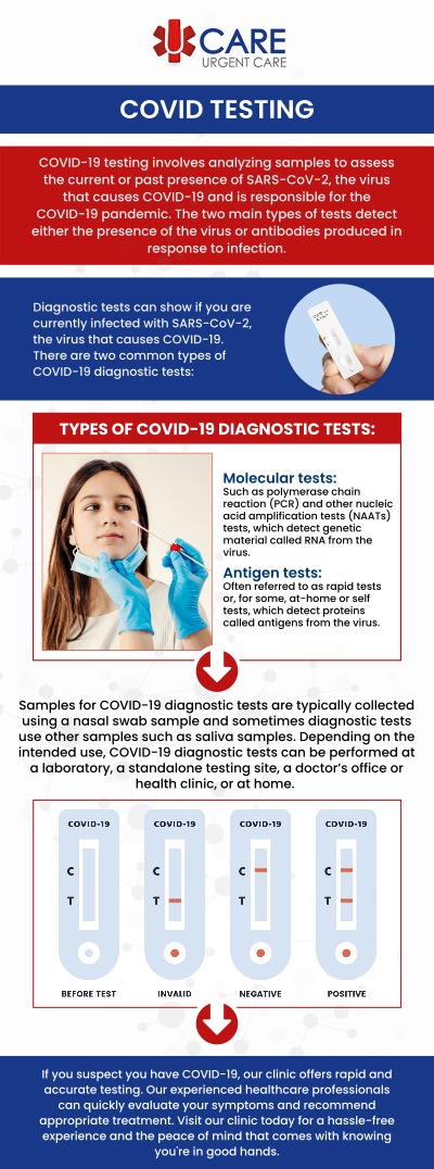COVID-19 testing is essential for monitoring your health and preventing the spread of the virus. At UCare Urgent Care and Walk-In Clinic, we offer fast and accurate COVID-19 testing to help keep you safe and informed. Our professional team provides reliable results with minimal wait times. We ensure a comfortable and efficient experience, making it easy to access the care you need. For more information, contact us today! We are conveniently located on North Zaragoza Rd. in El Paso TX, and Lee Trevino Dr. in El Paso TX. COVID-19 testing is essential for monitoring your health and preventing the spread of the virus. At UCare Urgent Care and Walk-In Clinic, we offer fast and accurate COVID-19 testing to help keep you safe and informed. Our professional team provides reliable results with minimal wait times. We ensure a comfortable and efficient experience, making it easy to access the care you need. For more information, contact us today! We are conveniently located on North Zaragoza Rd. in El Paso TX, and Lee Trevino Dr. in El Paso TX.