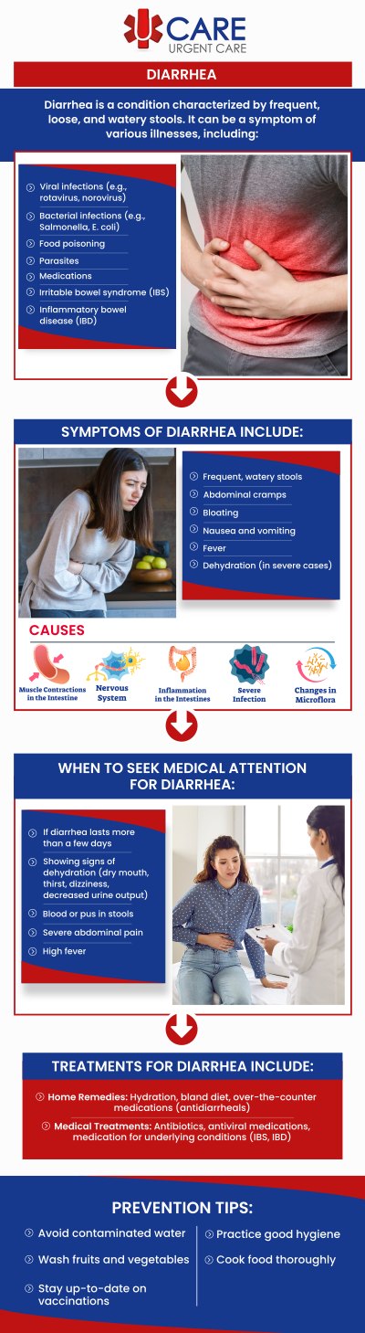 If you or someone you know is suffering from vomiting and diarrhea, come to UCare Urgent Care and Walk-In Clinic to seek treatment today. Our experienced doctors and medical staff provide comprehensive treatment. We are open 7 days a week, with convenient till 9:00 pm. Contact us today to speak to one of our specialists, or book an appointment online. We are a walk-in clinic located at Horizon City TX, on North Zaragoza Rd. in El Paso TX, and on Lee Trevino Dr. in El Paso TX. If you or someone you know is suffering from vomiting and diarrhea, come to UCare Urgent Care and Walk-In Clinic to seek treatment today. Our experienced doctors and medical staff provide comprehensive treatment. We are open 7 days a week, with convenient till 9:00 pm. Contact us today to speak to one of our specialists, or book an appointment online. We are a walk-in clinic located at Horizon City TX, on North Zaragoza Rd. in El Paso TX, and on Lee Trevino Dr. in El Paso TX.