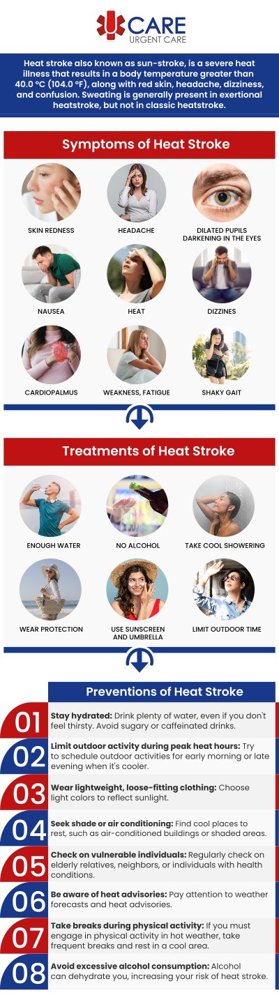 Heat stroke is a serious heat-related condition that requires immediate medical attention to help prevent complications. At UCare Urgent Care and Walk-In Clinic, our experienced team provides prompt evaluation and treatment for patients experiencing symptoms such as high body temperature, confusion, dizziness, rapid heartbeat, or other signs of severe heat exposure. We serve individuals and families throughout El Paso with convenient walk-in care designed to address urgent health concerns quickly and efficiently. Whether symptoms develop after outdoor activities, work, or prolonged heat exposure, our clinic is here to provide timely medical support and guidance. For more information, please contact us today or book an appointment online now. We are conveniently located on North Zaragoza Rd. in El Paso, TX, and on Lee Trevino Dr. in El Paso, TX. Heat stroke is a serious heat-related condition that requires immediate medical attention to help prevent complications. At UCare Urgent Care and Walk-In Clinic, our experienced team provides prompt evaluation and treatment for patients experiencing symptoms such as high body temperature, confusion, dizziness, rapid heartbeat, or other signs of severe heat exposure. We serve individuals and families throughout El Paso with convenient walk-in care designed to address urgent health concerns quickly and efficiently. Whether symptoms develop after outdoor activities, work, or prolonged heat exposure, our clinic is here to provide timely medical support and guidance. For more information, please contact us today or book an appointment online now. We are conveniently located on North Zaragoza Rd. in El Paso, TX, and on Lee Trevino Dr. in El Paso, TX.