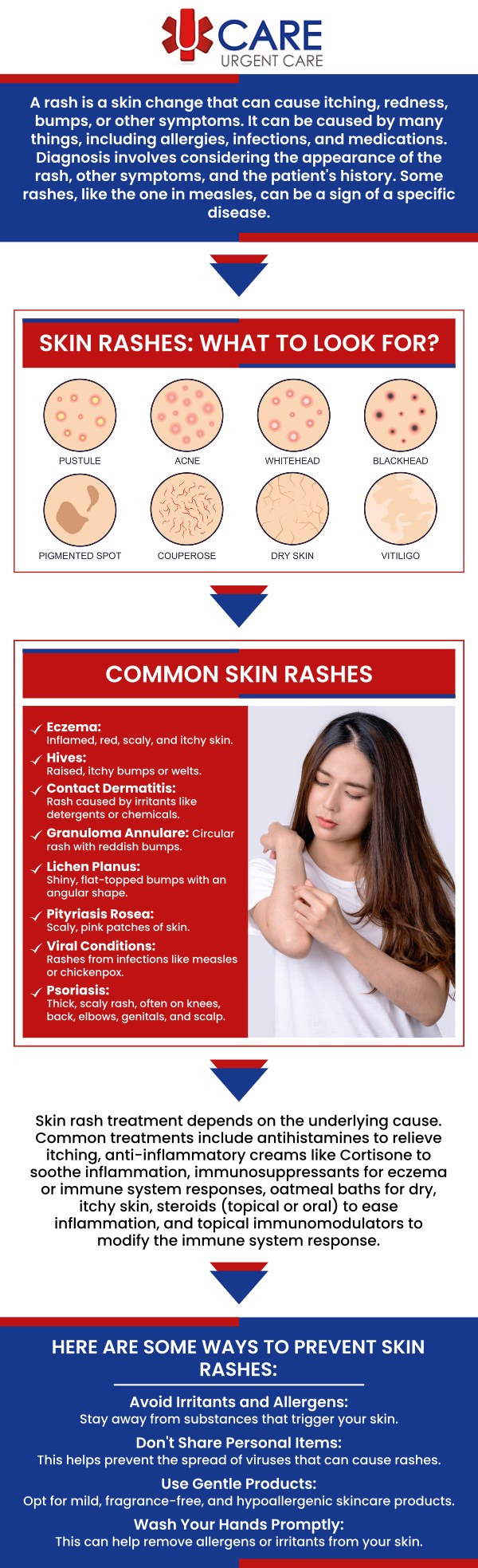 Visit UCare Urgent Care and Walk-in Clinic, we specialize in providing quality care for your day-to-day problems. Contact us today to speak to one of our specialists, or book an appointment online. We are a walk-in clinic located at Horizon City TX, on North Zaragoza Rd. in El Paso TX, and on Lee Trevino Dr. in El Paso TX. Visit UCare Urgent Care and Walk-in Clinic, we specialize in providing quality care for your day-to-day problems. Contact us today to speak to one of our specialists, or book an appointment online. We are a walk-in clinic located at Horizon City TX, on North Zaragoza Rd. in El Paso TX, and on Lee Trevino Dr. in El Paso TX.
