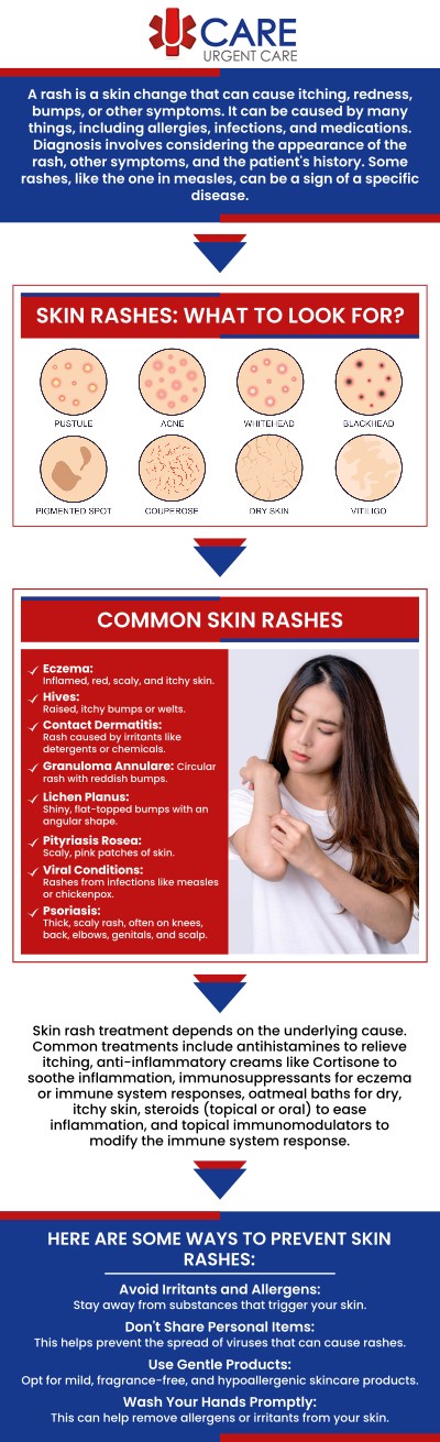 Visit UCare Urgent Care and Walk-in Clinic, we specialize in providing quality care for your day-to-day problems. Contact us today to speak to one of our specialists, or book an appointment online. We are a walk-in clinic located at Horizon City TX, on North Zaragoza Rd. in El Paso TX, and on Lee Trevino Dr. in El Paso TX. Visit UCare Urgent Care and Walk-in Clinic, we specialize in providing quality care for your day-to-day problems. Contact us today to speak to one of our specialists, or book an appointment online. We are a walk-in clinic located at Horizon City TX, on North Zaragoza Rd. in El Paso TX, and on Lee Trevino Dr. in El Paso TX.