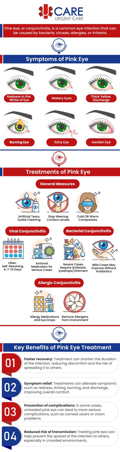 Pink eye treatment at urgent care can provide convenient access to evaluation and support when individuals experience symptoms such as eye redness, irritation, watering, or discomfort. Prompt assessment can help identify potential causes of pink eye and guide appropriate care recommendations based on each patient’s symptoms. At UCare Urgent Care & Walk-In Clinic, our professional medical team provides convenient urgent care for pink eye treatment, focusing on timely evaluations, patient education, and personalized support to help individuals better understand their eye health concerns. For more information, contact us today! We are conveniently located on North Zaragoza Rd. in El Paso TX, and on Lee Trevino Dr. in El Paso TX.