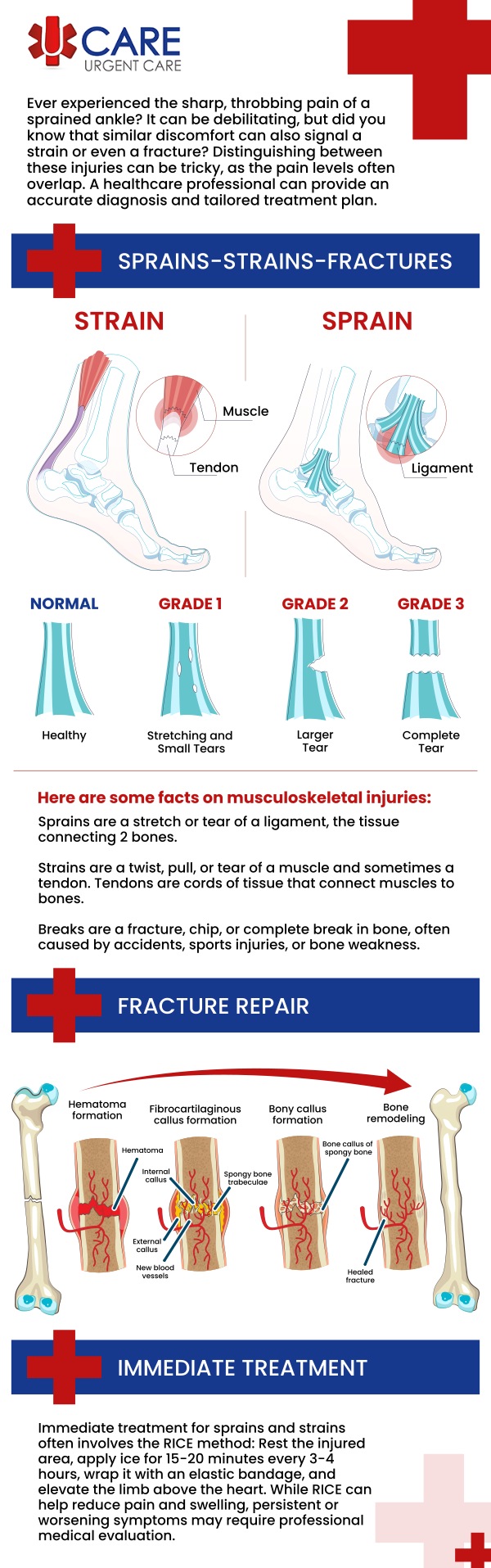 Day to day life can come to an immediate halt if you hurt yourself with a sprain or strain. Don't stay home and try to deal with it alone, visit UCare Urgent Care today. Our professional and caring staffs are here to help you when you need it. Contact us today or book an appointment online. We are a walk-in clinic located at Horizon City TX, on North Zaragoza Rd. in El Paso TX, and on Lee Trevino Dr. in El Paso TX. Day to day life can come to an immediate halt if you hurt yourself with a sprain or strain. Don't stay home and try to deal with it alone, visit UCare Urgent Care today. Our professional and caring staffs are here to help you when you need it. Contact us today or book an appointment online. We are a walk-in clinic located at Horizon City TX, on North Zaragoza Rd. in El Paso TX, and on Lee Trevino Dr. in El Paso TX.