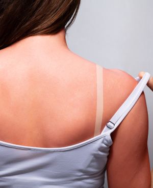 Sunburns Treatment Near Me in El Paso and Horizon City, TX
